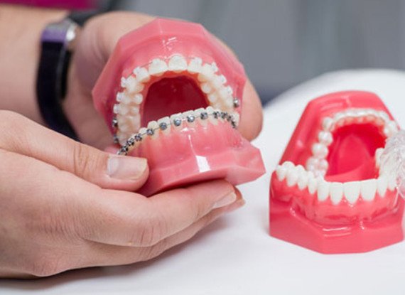 Orthodontics Fellowships Orthodontics Fellowships