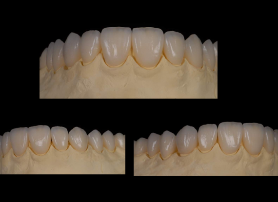 AESTHETICS DENTISTRY COURSE AESTHETICS DENTISTRY COURSE